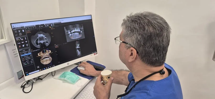 Implantes dentales