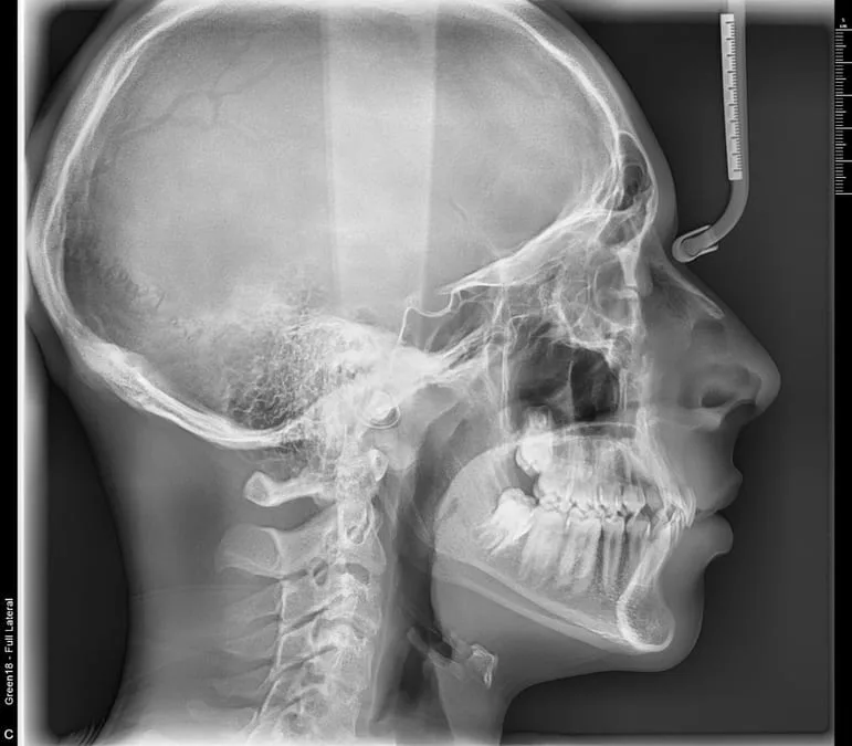 Radiografía 3D · CBCT